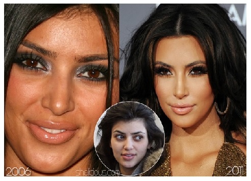 Kim-Kardashian-Before-and-After-Plastic-Surgery-1