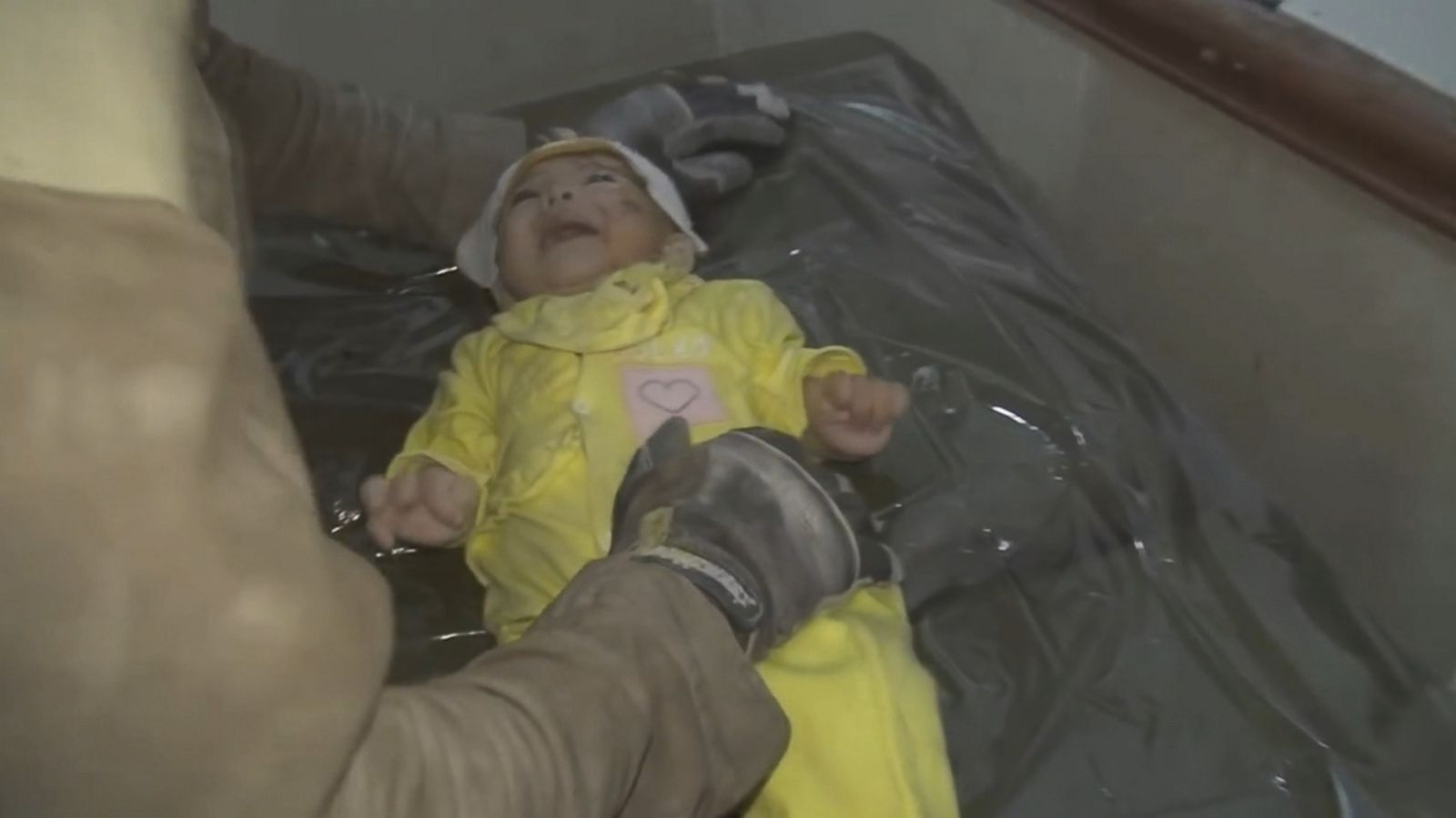 160930_vod_orig_syria_infant_victim_16x9_1600 (1)