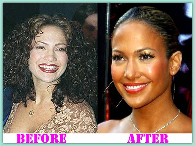 b4466cec4c8e91e8a39ea1147617aebb--jennifer-lopez-plastic-surgery-jenniferlopez