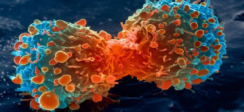 lung-cancer-cell-dividing-article.__v400248237-780x358