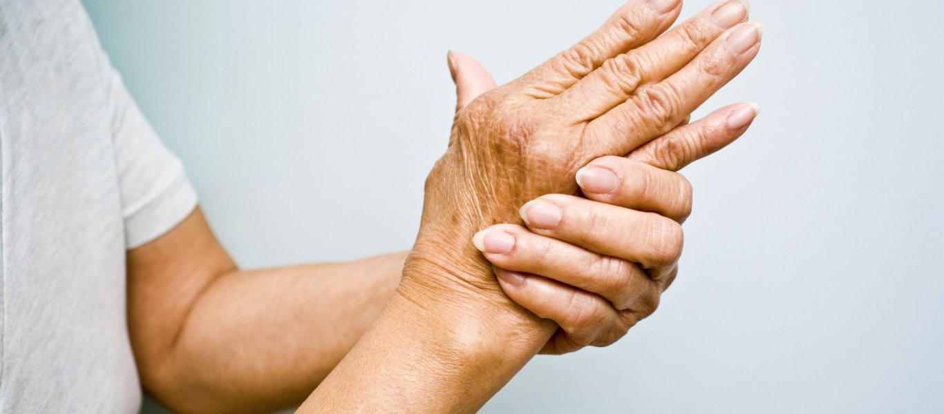 25924026_hands-rheumatoid-arthritis