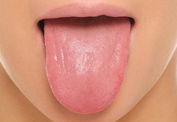 tongue