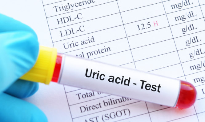 Blood sample tube with abnormal high uric acid test result