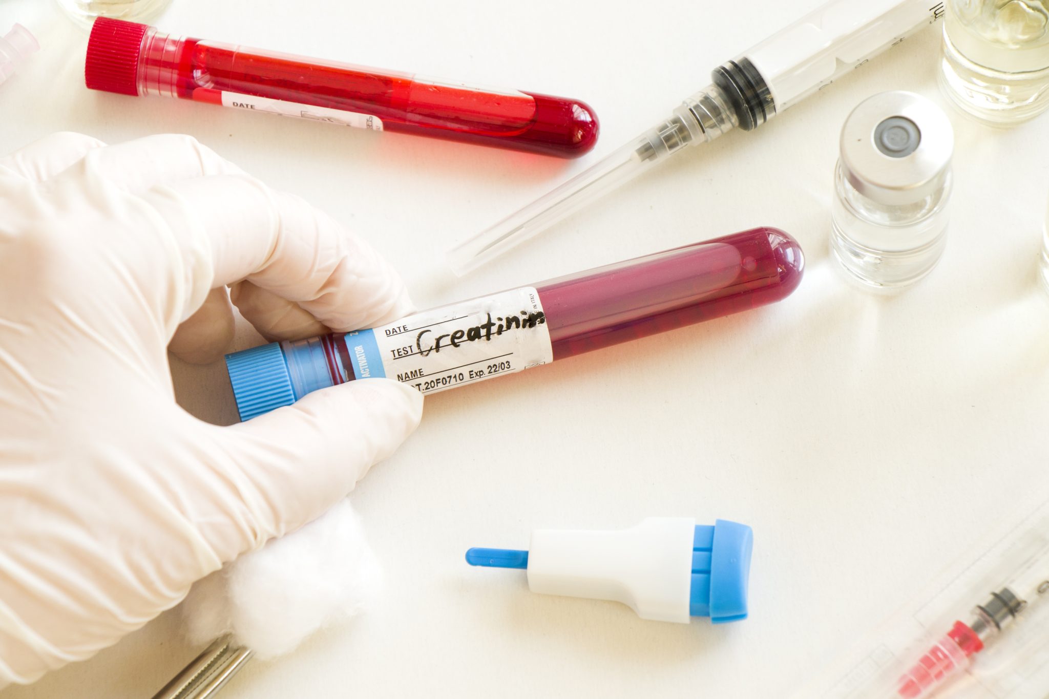 Creatinine-test-2048x1365