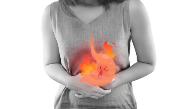 The Photo Of Cartoon Stomach On Woman's Body Against White Background, Acid Reflux Disease Symptoms Or Heartburn, Concept With Healthcare And Medicine