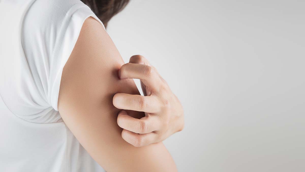 Woman scratching her arm.